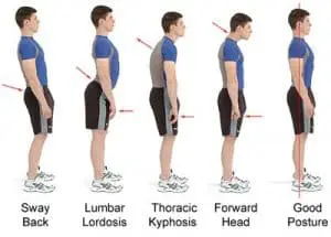 Proper Posture Chart - Back Pain