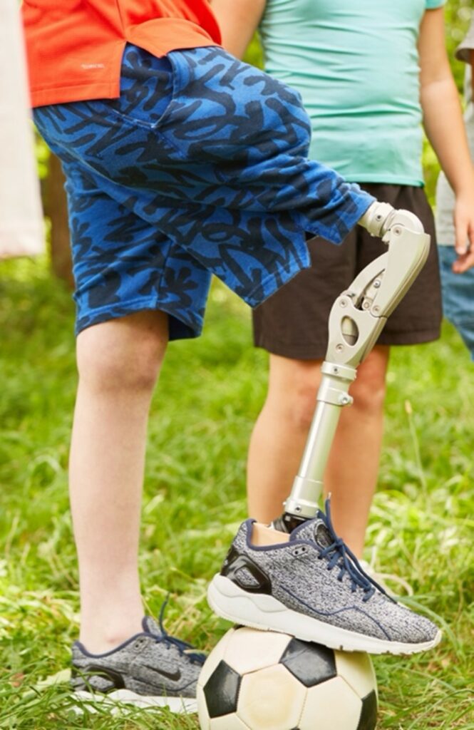 Student playing soccer with prosthetic leg